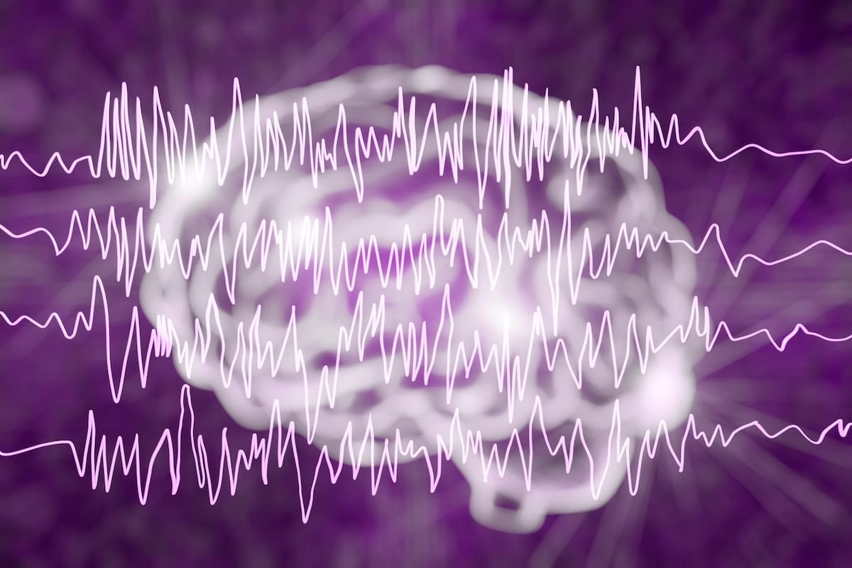 UK study shows cannabis improves outcomes in epilepsy patients